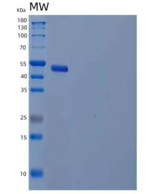 Recombinant Human Airway Trypsin-Like Protease 5/HATL5/TMPRSS11B Protein(C-6His)