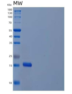 Recombinant Human Interleukin-21/IL-21 Protein