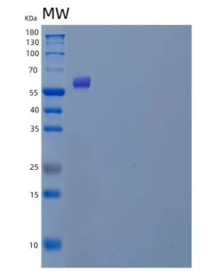 Recombinant Human Polypeptide GalNac Transferase 3/GALNT3 Protein(C-6His)