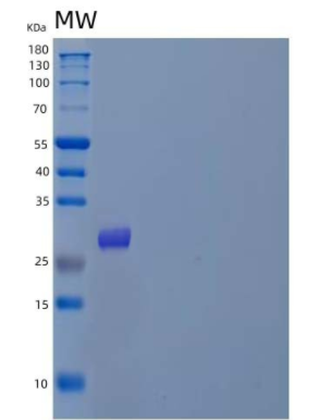 Recombinant Mouse Myostatin/MSTN/GDF-8 Protein(C-6His)