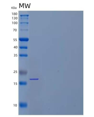 Recombinant Human Interleukin-33/IL-33 Protein(N-6His)