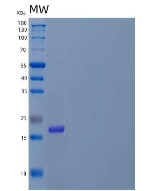 Recombinant Human Prefoldin Subunit 2/PFDN2 Protein(N-6His)