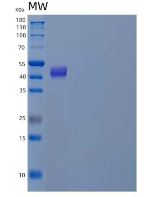 Recombinant Human DNA Polymerase δ Subunit 2/POLD2 Protein(C-6His)