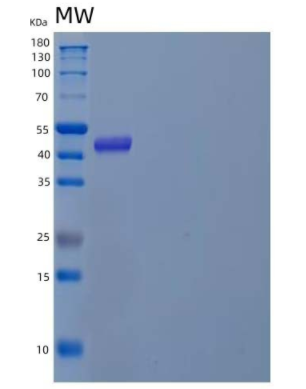 Recombinant Human Pregnancy-Specific β-1-Glycoprotein 1/PSG1 Protein(C-6His)