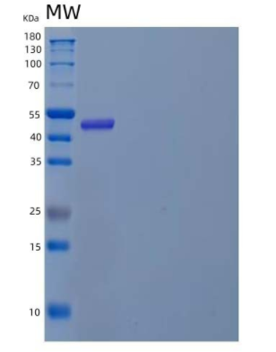 Recombinant Human Angiopoietin-Like Protein 8/ANGPTL8/βtrophin Protein(N-Fc)