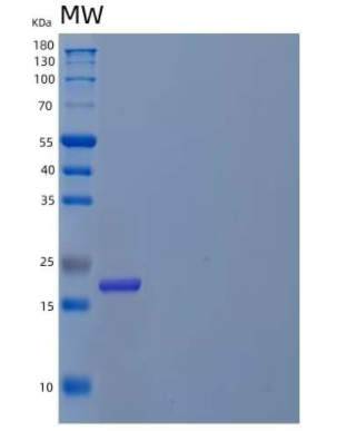 Recombinant Human D-Tyrosyl-tRNA Protein