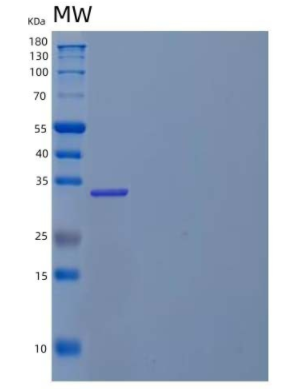 Recombinant Human Pregnancy-Specific β-1-Glycoprotein 2/PSG2 Protein(C-6His)