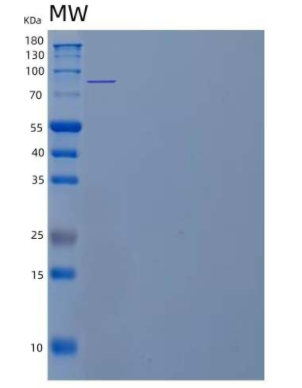 Recombinant Human Interleukin-5 Receptor Subunit Alpha/IL-5 Rα Protein(C-Fc)