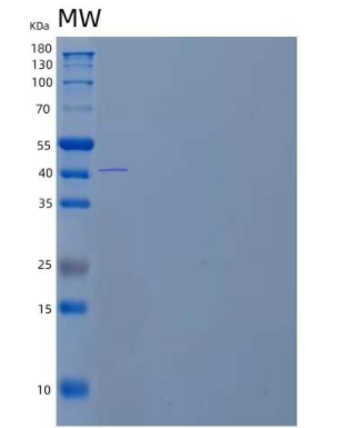 Recombinant Human Pregnancy-Specific β-1-Glycoprotein 3/PSG3 Protein(C-6His)