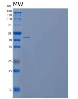 Recombinant Human Angiotensinogen/Serpin A8/AGT Protein(C-6His)