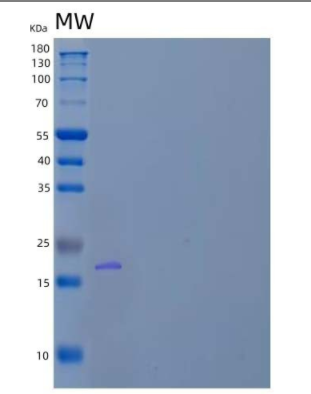 Recombinant Human dUTP Pyrophosphatase/dUTPase Protein.