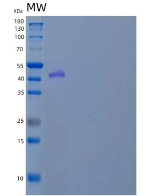 Recombinant Human Pregnancy-Specific β-1-Glycoprotein 9/PSBG9 Protein(C-6His)