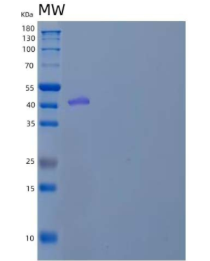 Recombinant Mouse Plasminogen Activator Inhibitor 1/PAI-1/SERPIN E1 Protein(C-6His)