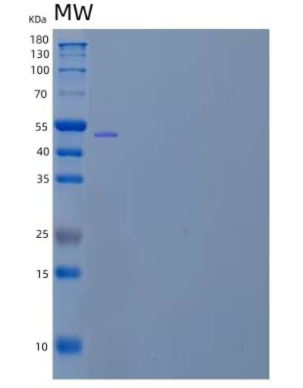 Recombinant Mouse Plexin Domain-Containing Protein 2/PLXDC2 Protein(C-6His)