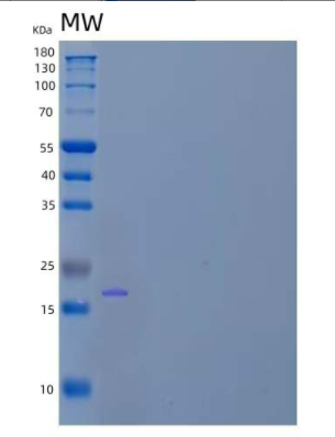 Recombinant Human Early Placenta Insulin-Like Peptide/INSL4/Placentin Protein(C-6His)