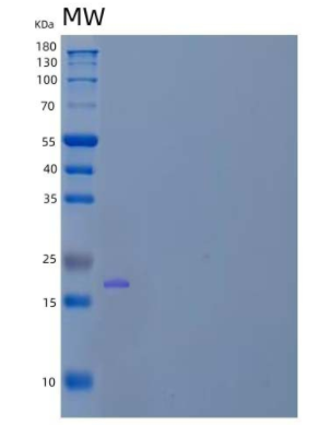 Recombinant Human Interleukin-9/IL-9/Cytokine P40 Protein(C-6His)