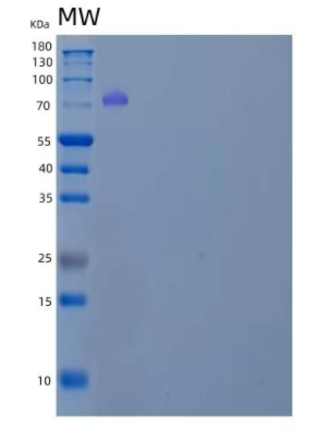 Recombinant Human Inter-α-Trypsin Inhibitor Heavy Chain H3/ITIH3 Protein(C-6His)