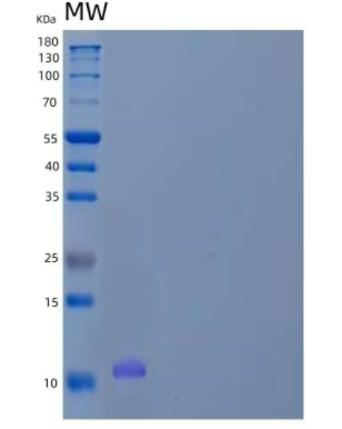 Recombinant Human WW Domain-Binding Protein 1/WBP1 Protein(N-6His)