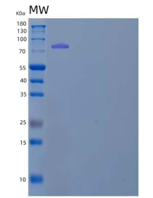 Recombinant Mouse Semaphorin 4C/SEMA4C Protein(C-Fc)