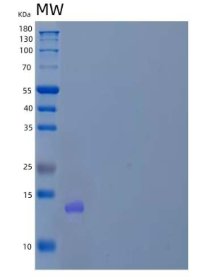 Recombinant Human Proprotein Convertase Subtilisin/Kexin Type 9/PCSK9 Protein(C-6His/HA/AVI)