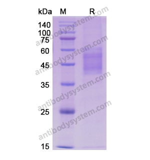 Recombinant Human CD25/IL2RA, C-His