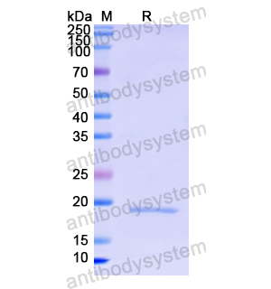 Recombinant Human CD8A, N-His