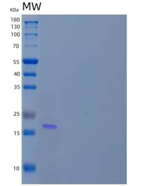 Recombinant Human Zinc Finger HIT Domain-Containing Protein 1/ZNHIT1/ZNFN4A1 Protein(N-6His)