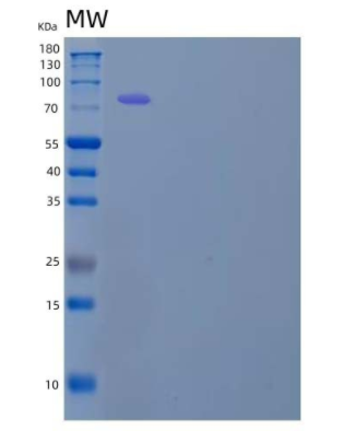 Recombinant Human Ephrin B Receptor 1/EphB1 Protein(C-Fc)