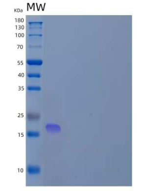 Recombinant Human Protachykinin-1/TAC1 Protein(N-6His)