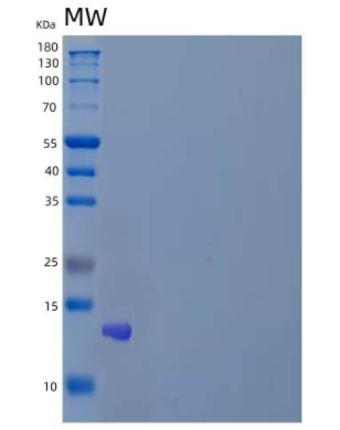 Recombinant Human Krueppel-Like Factor 6/KLF6 Protein