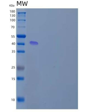 Recombinant Human Prostatic Acid Phosphatase/ACPP Protein(C-6His)