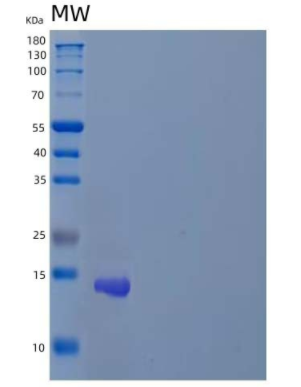 Recombinant Human Zinc Finger Protein 75A/ZNF75A Protein(N-6His)