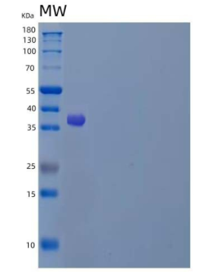 Recombinant Human LAMP1/CD107a Protein(C-6His)