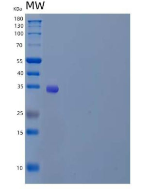 Recombinant Human α-Soluble NSF Attachment Protein/SNAP-α/NAPA Protein(N-6His)