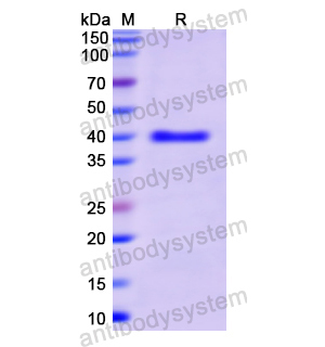 Recombinant Human PIGR, N-His