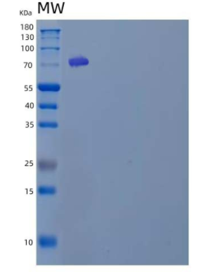 Recombinant Human Protein-Arginine Deiminase Type-4/PADI4 Protein(N-6His)