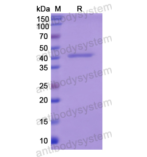 Recombinant Human HBD, N-GST