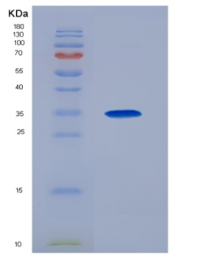 Eukaryotic Receptor Activator Of Nuclear Factor Kappa B Ligand (RANkL)