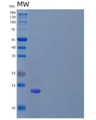 Recombinant Human Estrogen Receptor α/ERα/NR3A1 Protein(N-6His)