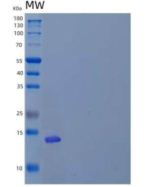 Recombinant Human T cell Immunoreceptor with Ig and ITIM domains Protein/VSTM3