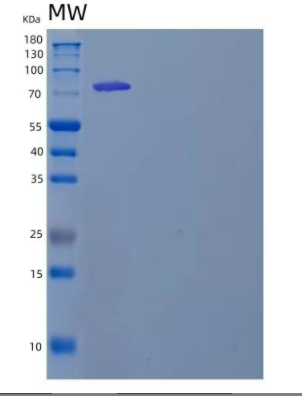 Recombinant Mouse Transglutaminase 2/TGM2 Protein(C-6His)