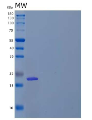 Recombinant Human BNIP3/NIP3 Protein(N-6His)