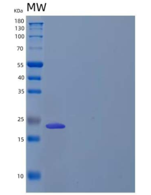 Recombinant Human RANK L/TRANCE/TNFSF11 Protein(N-6His)