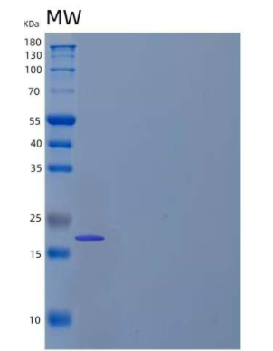 Recombinant Human ?3-Glutamylaminecyclotransferase/GGACT Protein(N-6His)