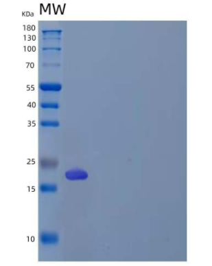 Recombinant Human Regenerating Islet-Derived Protein 3-γ/Reg3γ/REG3G Protein(C-6His)