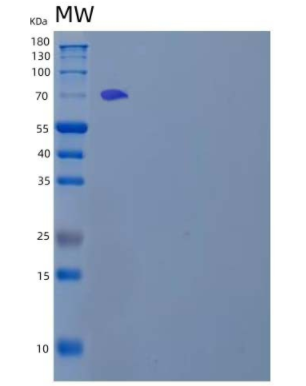 Recombinant Human Cadherin-17/LI-Cadherin/CDH17 Protein(C-6His)