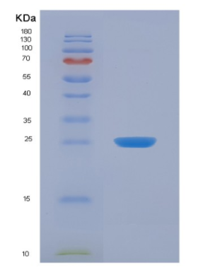 Recombinant Fibroblast Growth Factor Intracellular Binding Protein (FIBP)