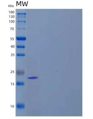 Recombinant Human Fibroblast Growth Factor 2/FGF-2/FGFb (Met134-Ser288) Protein