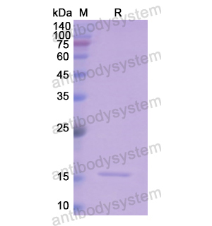 Recombinant Human CD235a/GYPA, N-His