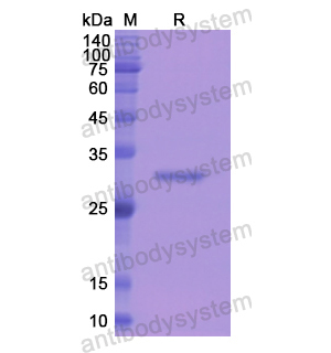 Recombinant Human CD233/SLC4A1, N-His